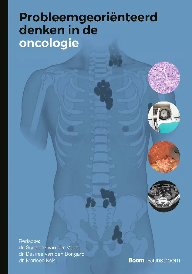Probleemgeoriënteerd denken in de oncologie