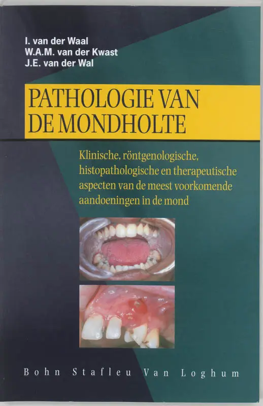 Pathologie van de mondhol