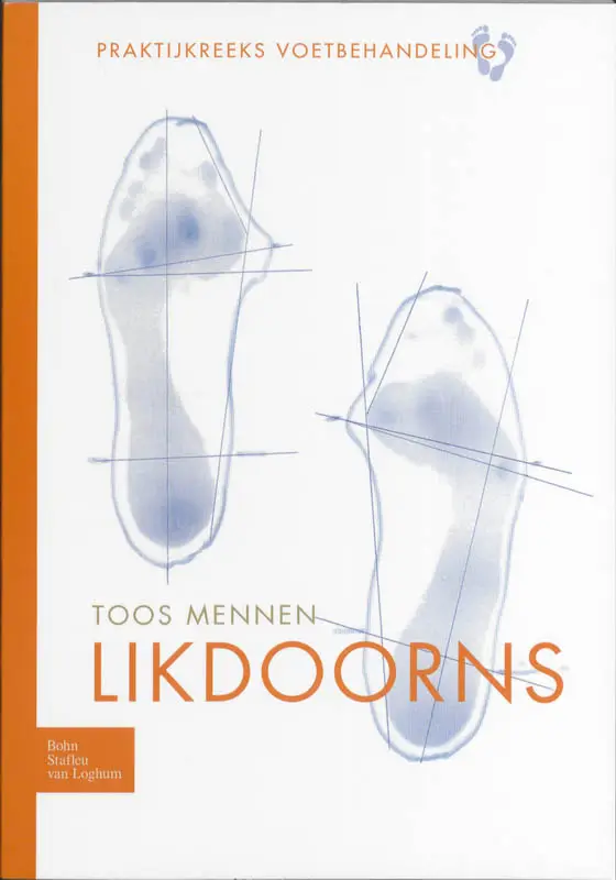 Likdoorns