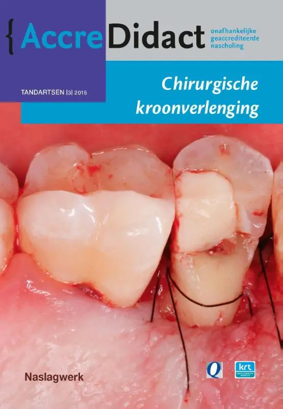 Chirurgische kroonverlenging