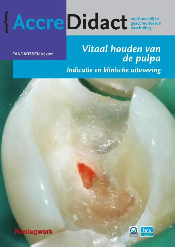 Vitaal houden van de pulpa