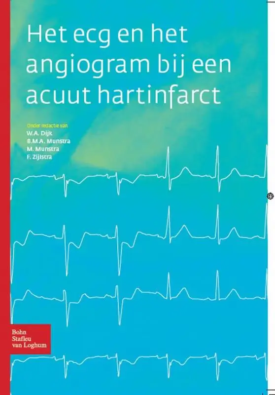 Het ECG en het angiogram