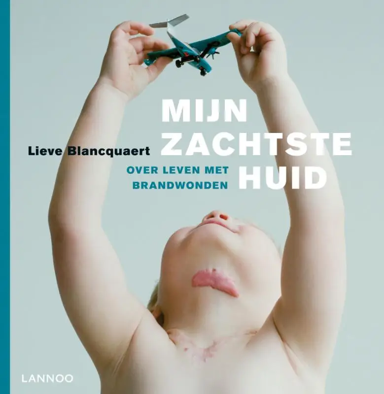 Mijn zachtste huid / druk